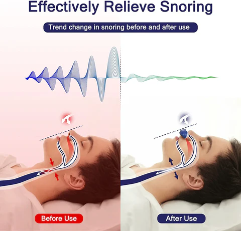 Micro CPAP søvnapné maskine til rejse og anti-snorken - CPAP alternativ