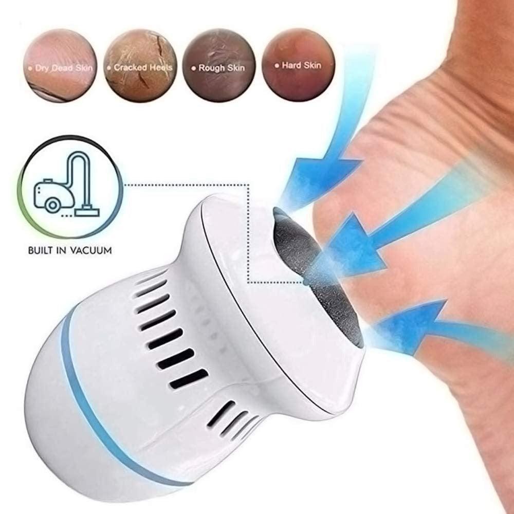 Silksole™ - Genopladelig elektrisk fodhudstrimmer