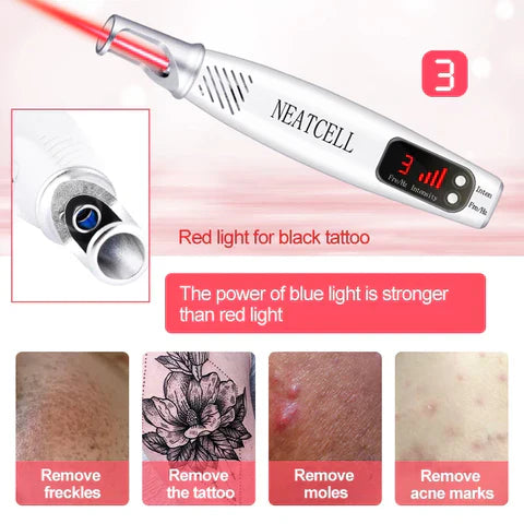 AstraGlow Kompakt Laser Pen Til Fjernelse Af Tattoos, Modermærker Og Frækner