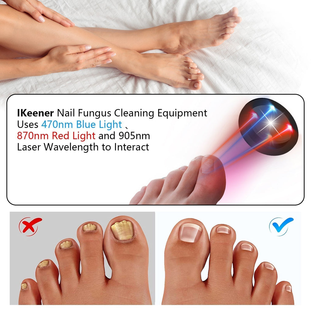 ApexNova Laser Neglesystem Til Nem Hjemmebrug Og DIY Pleje