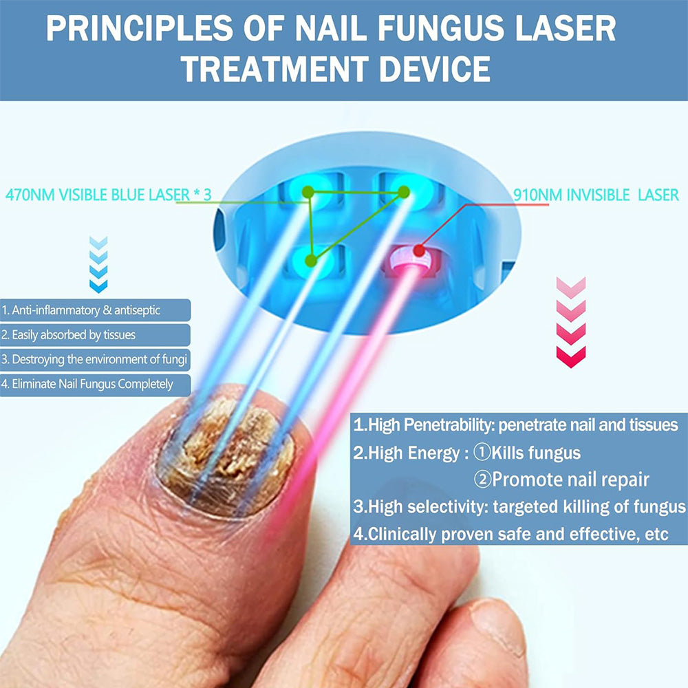 Professionelt Nail Laser Apparater til Hjemmet til Tånegle