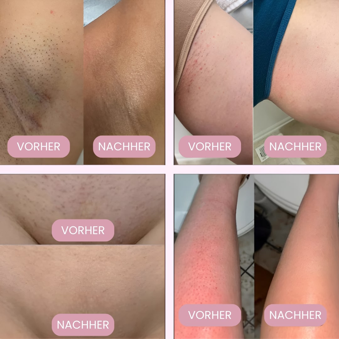 Intimbarbermaskine til kvinder | Elektrisk damebarbermaskine til intimområdet | Bikini Trimmer | Femora