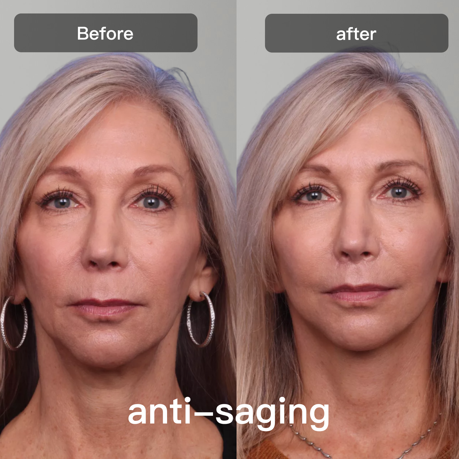 Syv-bølges LED-lysbehandlingsapparat til ansigt og krop